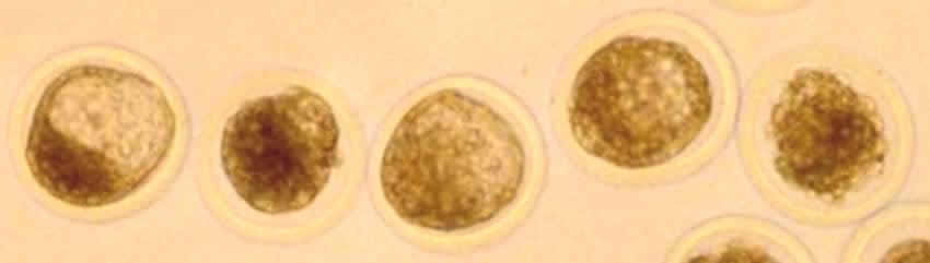 Embryo Flush